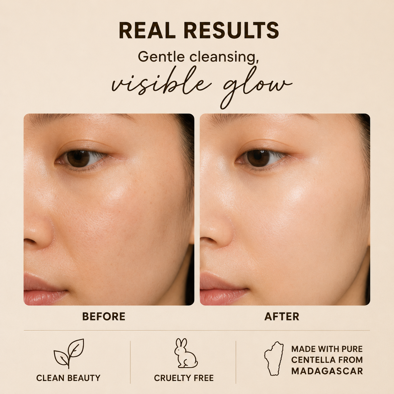 Skin1004 Madagascar Centella Light Cleansing Oil β Gentle Makeup Remover