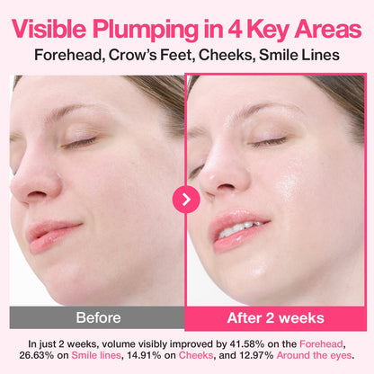 No.2 Rose PDRN Collagen Plumping Serum 30ml | Numbuzin