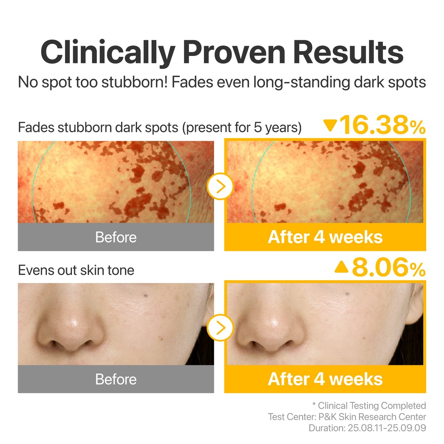 No.5 Glutathione TXA Advanced Dark Spot Ampoule | Numbuzin