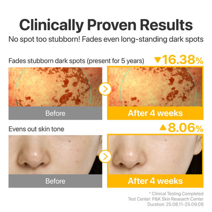 No.5 Glutathione TXA Advanced Dark Spot Ampoule | Numbuzin