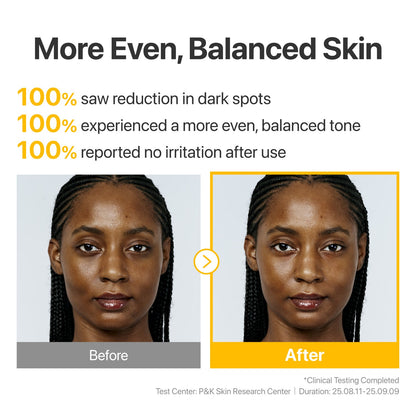 No.5 Glutathione TXA Advanced Dark Spot Ampoule | Numbuzin