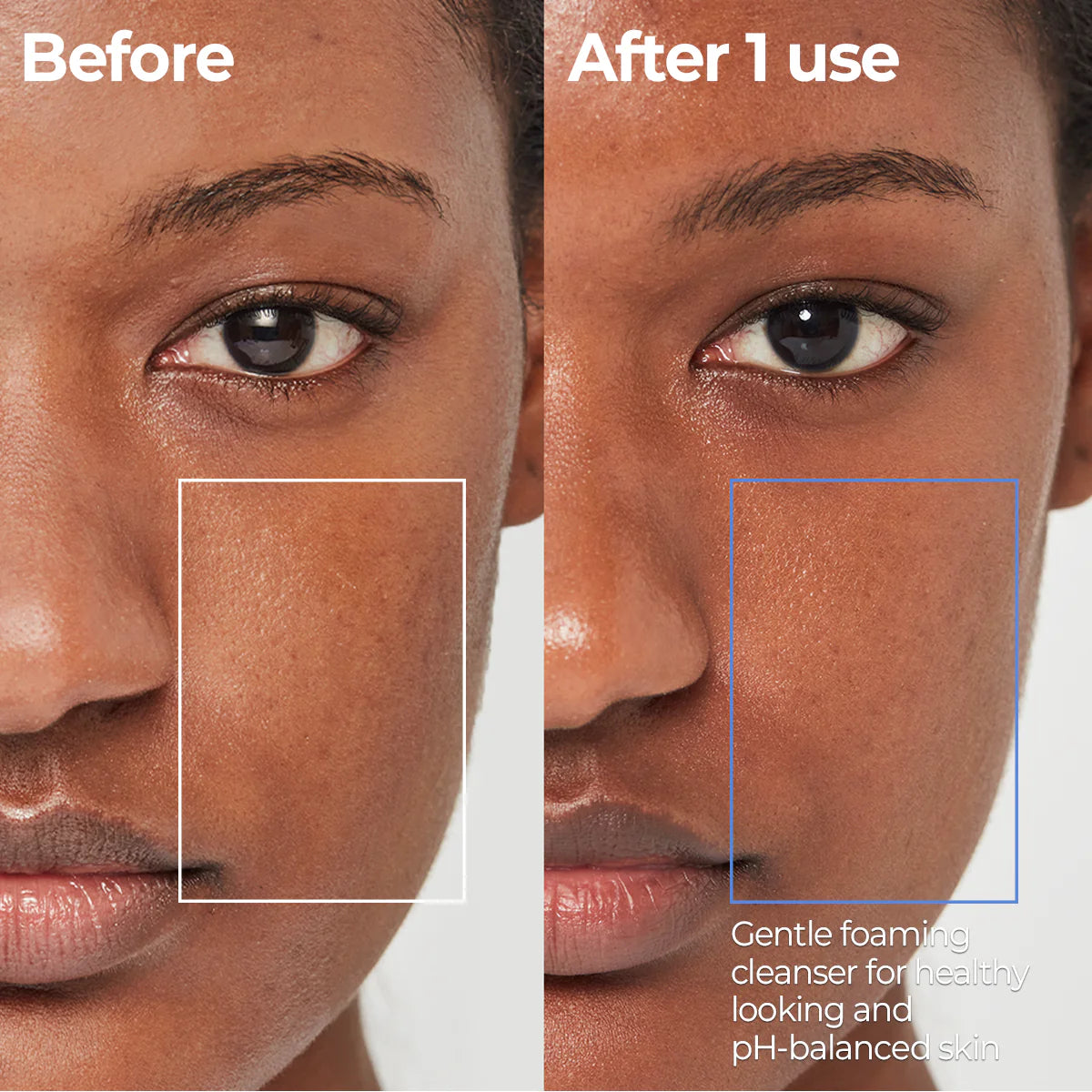 [Aestura] Atobarrier 365 Foaming Cleanser (150ml / 5.07 fl oz)