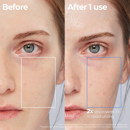 [Aestura] Atobarrier 365 Lotion (250ml)