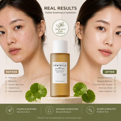 Skin1004 Madagascar Centella Toning Toner – Soothing Hydrating Facial Toner