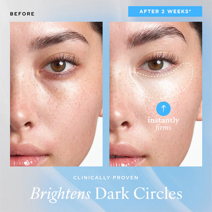 [ BELIF ] Aqua Bomb Eye Gel (25ml)