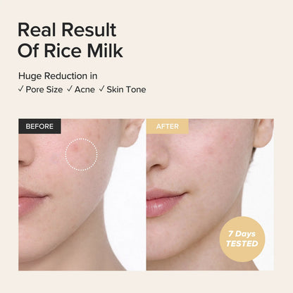 [Beauty of Joseon] Glow Replenishing Rice Milk 150ml